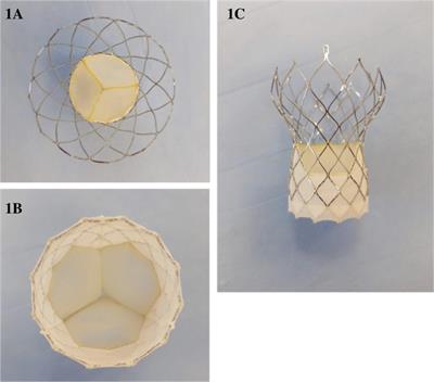 Safety and performance of the Vienna self-expandable transcatheter aortic valve system: 6-month results of the VIVA first-in-human feasibility study